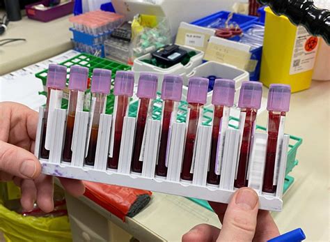 how are blood samples analysed